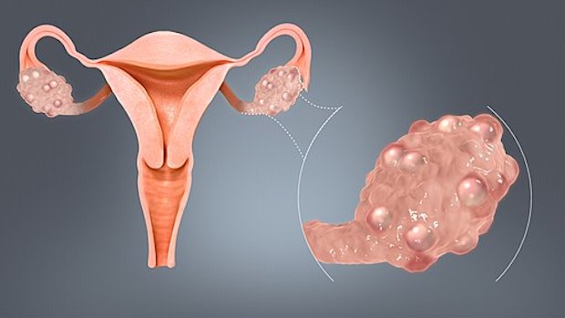 a diagram of follicles on an ovary